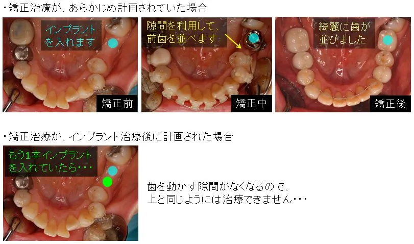 矯正治療